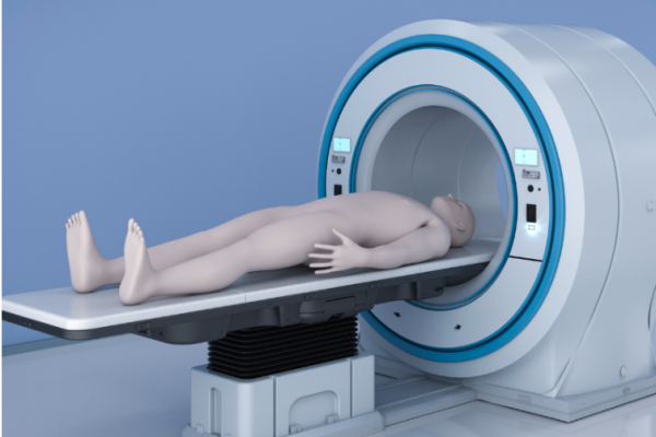 65d867dd974d9eb746e36cdf_Blog3