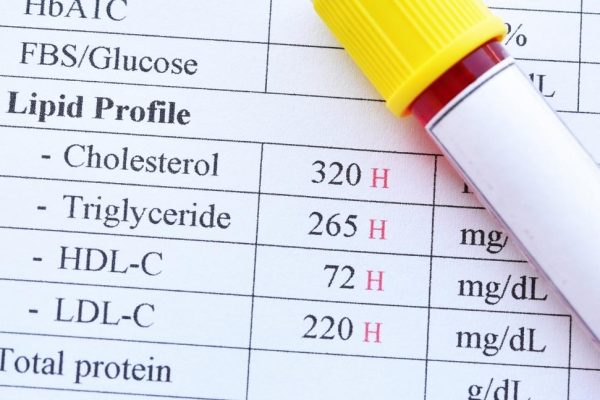 Cholesterol-Test-Results
