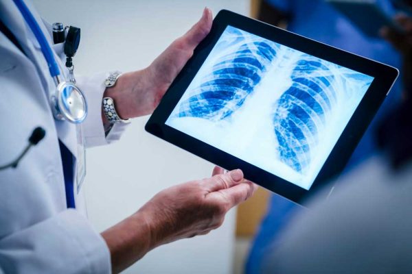 Doctor-holding-image-of-chest-xray