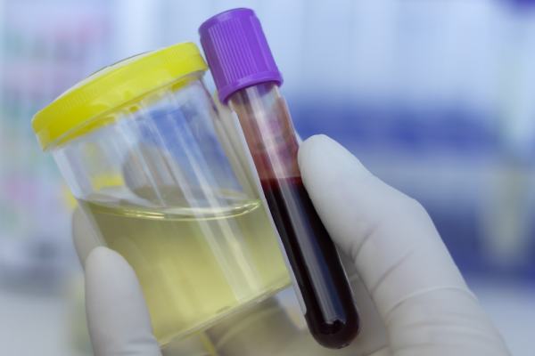 On-Point-Labs_May_Blog_Featured-Image