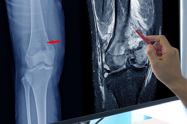 mri-vs-x-ray-comparison-1024x585