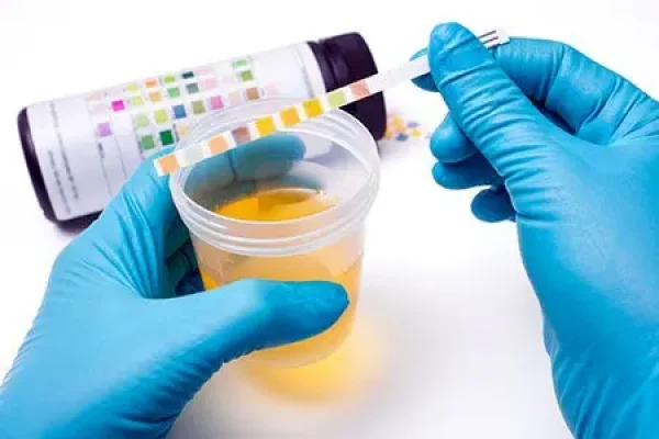 urinalysis-2